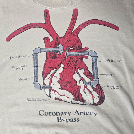 Vintage 1980s Coronary Artery Bypass Shirt